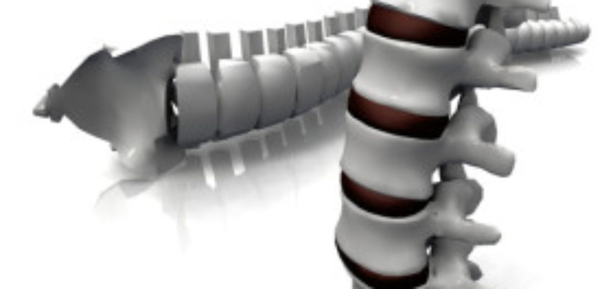 spinal fusion surgery new york