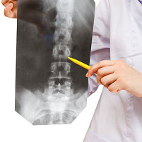 Minimally Invasive Spine Surgery NYC