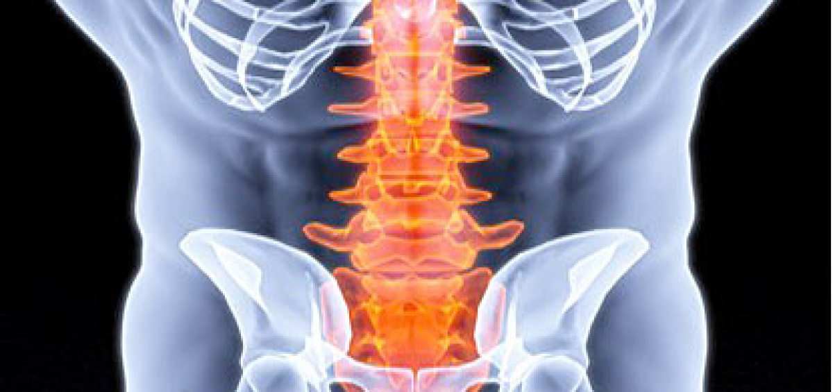lumbar spinal stenosis